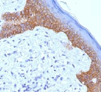 Immunohistochemistry (Formalin/PFA-fixed paraffin-embedded sections) - Anti-Desmoglein 3/PVA antibody [5G11] - BSA and Azide free (AB218851)
