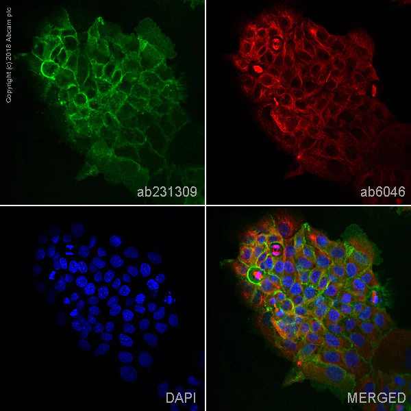 Immunocytochemistry/ Immunofluorescence - Anti-Desmoglein 3/PVA antibody [5H10] (AB231309)