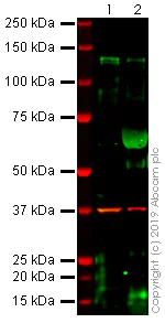 Western blot - Anti-Desmoglein 3/PVA antibody [5H10] (AB231309)