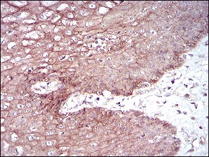 Immunohistochemistry (Formalin/PFA-fixed paraffin-embedded sections) - Anti-Desmoglein 3/PVA antibody [6G2C11] (AB201968)