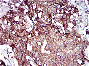 Immunohistochemistry (Formalin/PFA-fixed paraffin-embedded sections) - Anti-Desmoglein 3/PVA antibody [6G2C11] (AB201968)