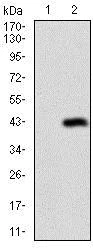 Western blot - Anti-Desmoglein 3/PVA antibody [6G2C11] (AB201968)