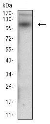 Western blot - Anti-Desmoglein 3/PVA antibody [6G2C11] (AB201968)