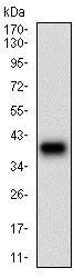 Western blot - Anti-Desmoglein 3/PVA antibody [6G2C11] (AB201968)