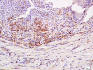 Immunohistochemistry (Formalin/PFA-fixed paraffin-embedded sections) - Anti-Desmoglein 3/PVA antibody (AB203692)