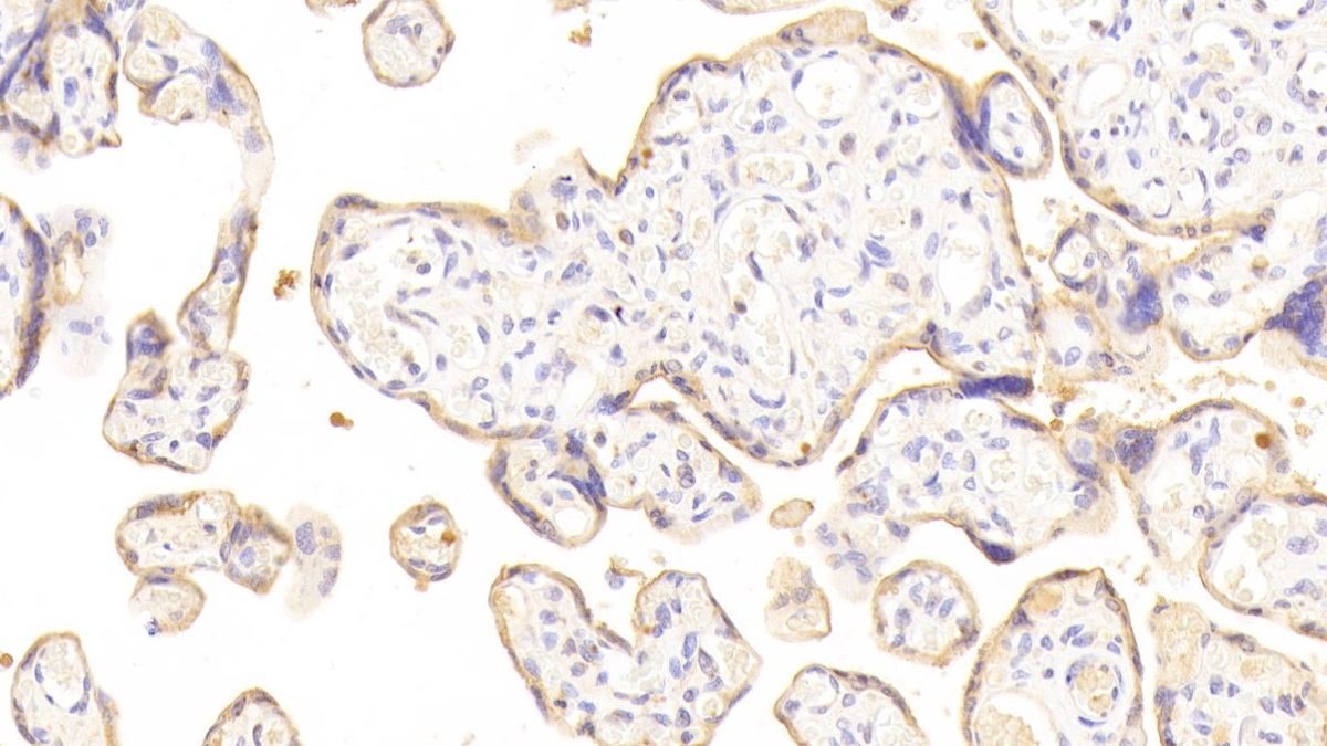 Immunohistochemistry (Formalin/PFA-fixed paraffin-embedded sections) - Anti-Desmoglein 3/PVA antibody (AB231947), expandable thumbnail