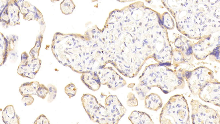 Immunohistochemistry (Formalin/PFA-fixed paraffin-embedded sections) - Anti-Desmoglein 3/PVA antibody (AB231947)