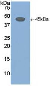 Western blot - Anti-Desmoglein 3/PVA antibody (AB231947), expandable thumbnail