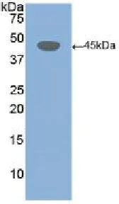 Western blot - Anti-Desmoglein 3/PVA antibody (AB231947)
