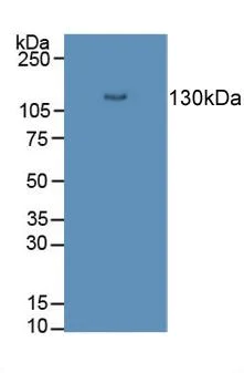 Western blot - Anti-Desmoglein 3/PVA antibody (AB231947)