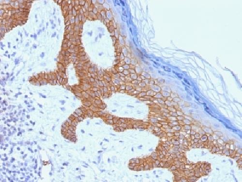 Immunohistochemistry (Formalin/PFA-fixed paraffin-embedded sections) - Anti-Desmoglein 3/PVA antibody [DSG3/1535] (AB218380)