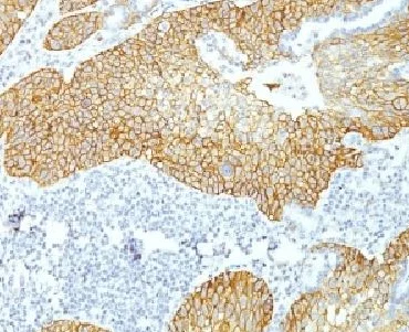 Immunohistochemistry (Formalin/PFA-fixed paraffin-embedded sections) - Anti-Desmoglein 3/PVA antibody [DSG3/1535] (AB218380)