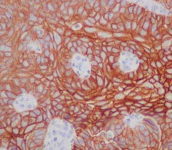 Immunohistochemistry (Formalin/PFA-fixed paraffin-embedded sections) - Anti-Desmoglein 3/PVA antibody [EPR14101] - BSA and Azide free (AB250705), expandable thumbnail
