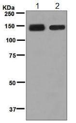 Western blot - Anti-Desmoglein 3/PVA antibody [EPR7420] (AB128927)
