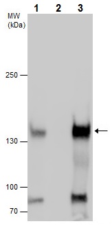 Immunoprecipitation - Anti-Desmoglein 3/PVA antibody - N-terminal (AB228726)