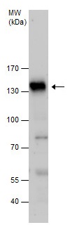 Western blot - Anti-Desmoglein 3/PVA antibody - N-terminal (AB228726)