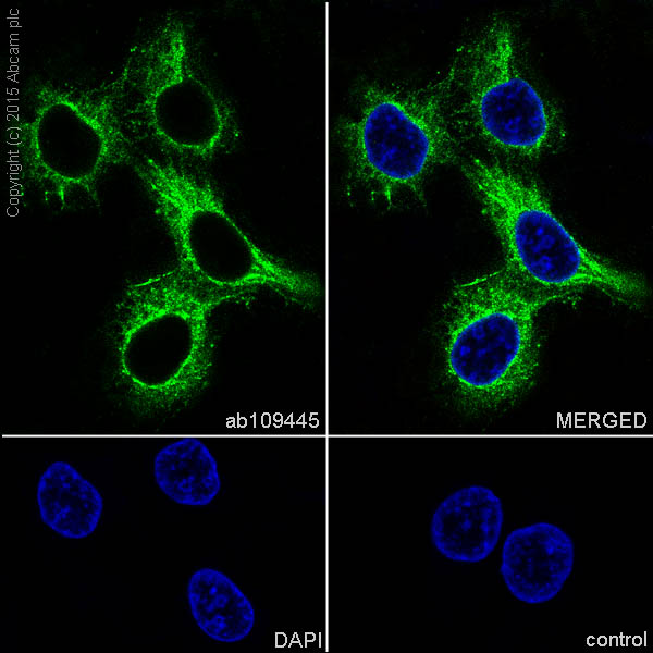 Immunocytochemistry/ Immunofluorescence - Anti-Desmoplakin antibody [EPR4383(2)] (AB109445), expandable thumbnail