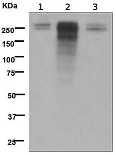 Western blot - Anti-Desmoplakin antibody [EPR4383(2)] (AB109445), expandable thumbnail
