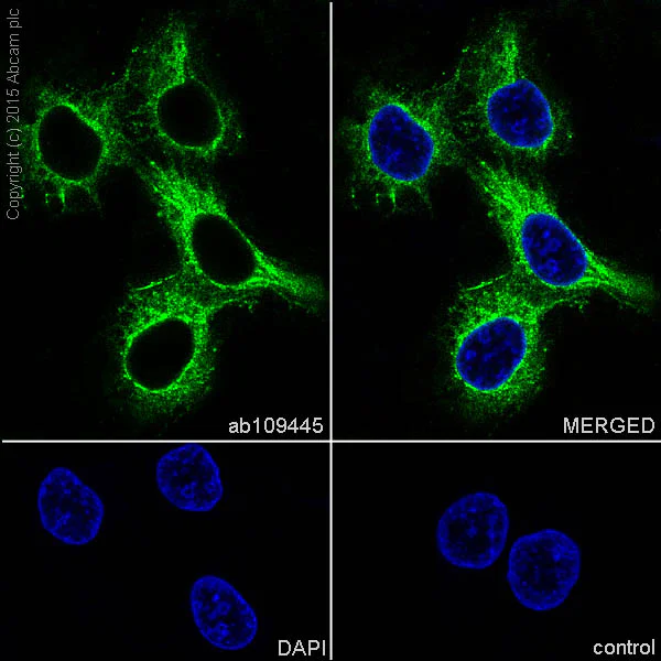 Immunocytochemistry/ Immunofluorescence - Anti-Desmoplakin antibody [EPR4383(2)] - BSA and Azide free (AB247866)