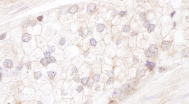 Immunohistochemistry (Formalin/PFA-fixed paraffin-embedded sections) - Anti-Desmoplakin I+II antibody (AB118804)