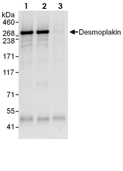 Immunoprecipitation - Anti-Desmoplakin I+II antibody (AB118804)