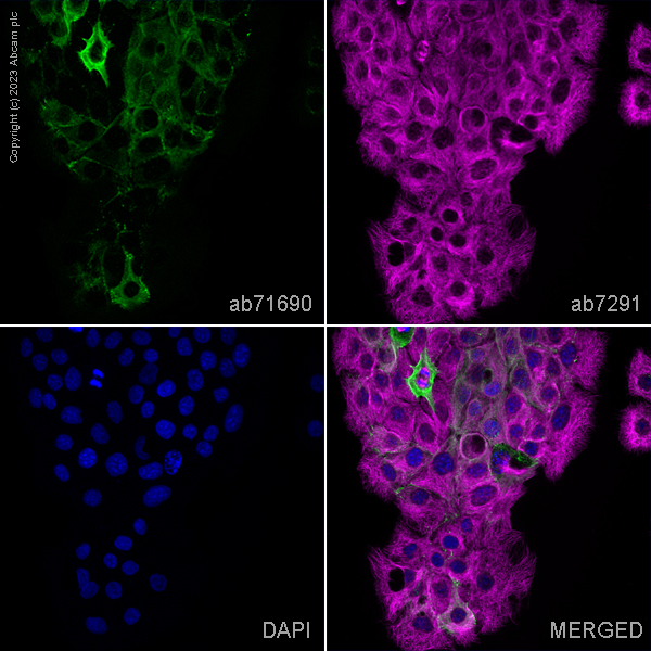 Immunocytochemistry/ Immunofluorescence - Anti-Desmoplakin I+II antibody (AB71690)