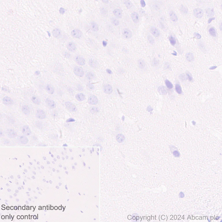 Immunohistochemistry (Formalin/PFA-fixed paraffin-embedded sections) - Anti-Desmoplakin I+II antibody [EPR28426-66] (AB316760)