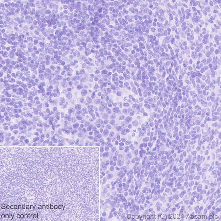 Immunohistochemistry (Formalin/PFA-fixed paraffin-embedded sections) - Anti-Desmoplakin I+II antibody [EPR28426-66] (AB316760)