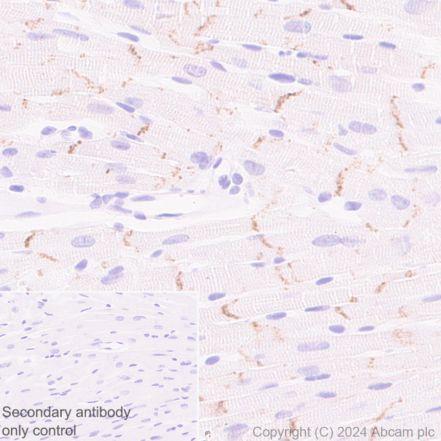 Immunohistochemistry (Formalin/PFA-fixed paraffin-embedded sections) - Anti-Desmoplakin I+II antibody [EPR28426-66] - BSA and Azide free (ab316761), expandable thumbnail