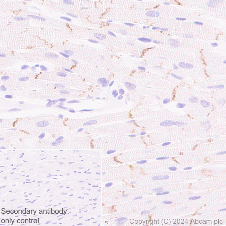 Immunohistochemistry (Formalin/PFA-fixed paraffin-embedded sections) - Anti-Desmoplakin I+II antibody [EPR28426-66] - BSA and Azide free (AB316761)