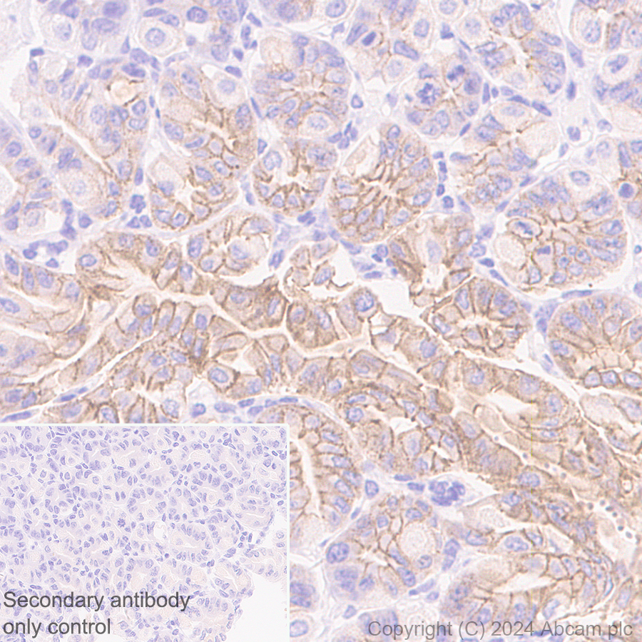 Immunohistochemistry (Formalin/PFA-fixed paraffin-embedded sections) - Anti-Desmoplakin I+II antibody [EPR28426-66] - BSA and Azide free (ab316761), expandable thumbnail
