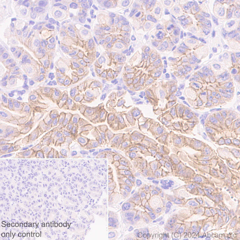 Immunohistochemistry (Formalin/PFA-fixed paraffin-embedded sections) - Anti-Desmoplakin I+II antibody [EPR28426-66] - BSA and Azide free (AB316761)