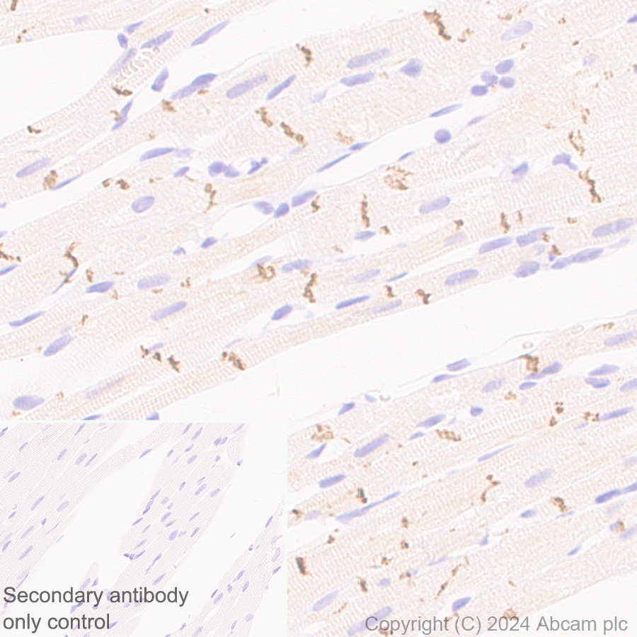 Immunohistochemistry (Formalin/PFA-fixed paraffin-embedded sections) - Anti-Desmoplakin I+II antibody [EPR28426-66] - BSA and Azide free (AB316761), expandable thumbnail