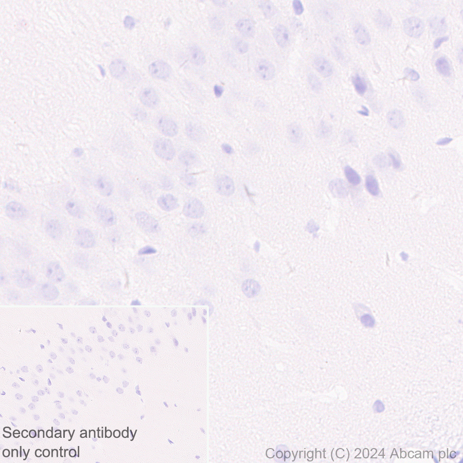 Immunohistochemistry (Formalin/PFA-fixed paraffin-embedded sections) - Anti-Desmoplakin I+II antibody [EPR28426-66] - BSA and Azide free (AB316761), expandable thumbnail