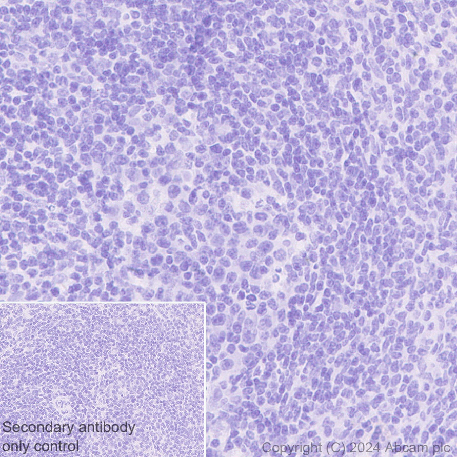 Immunohistochemistry (Formalin/PFA-fixed paraffin-embedded sections) - Anti-Desmoplakin I+II antibody [EPR28426-66] - BSA and Azide free (AB316761), expandable thumbnail