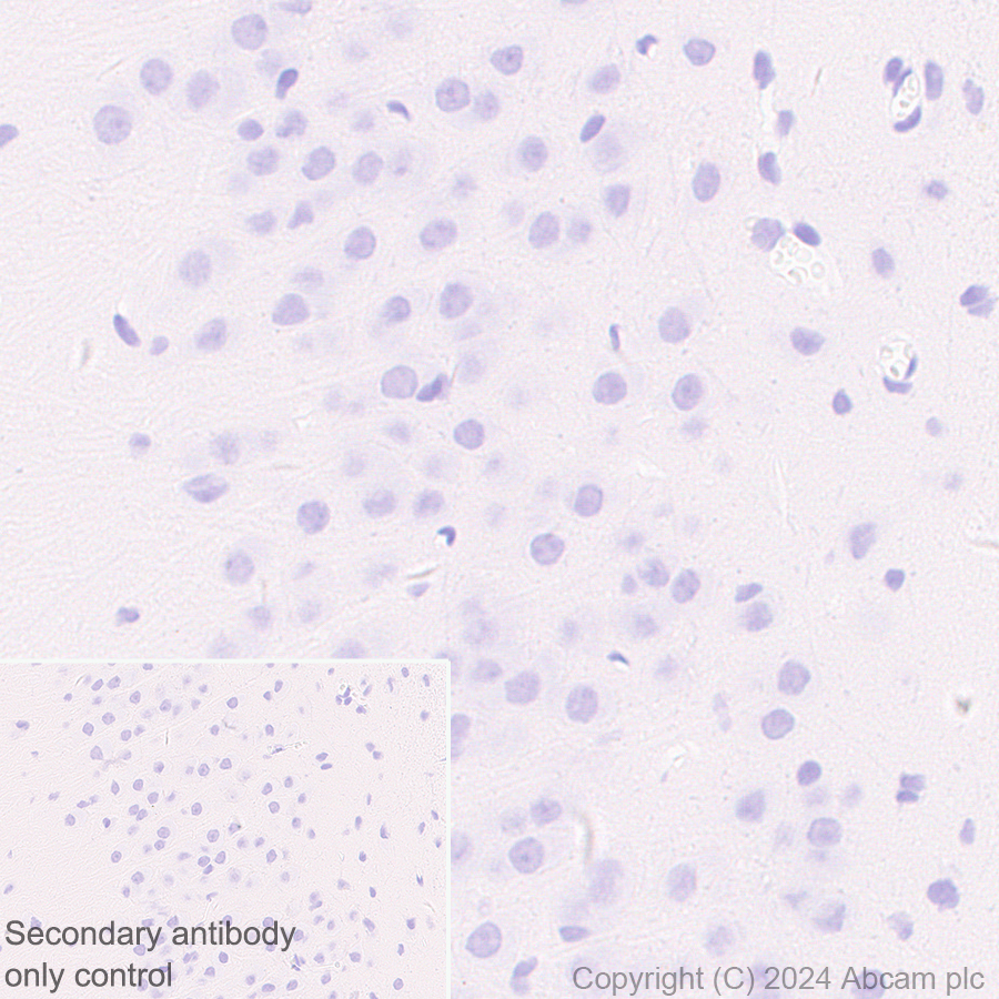 Immunohistochemistry (Formalin/PFA-fixed paraffin-embedded sections) - Anti-Desmoplakin I+II antibody [EPR28426-66] - BSA and Azide free (AB316761), expandable thumbnail