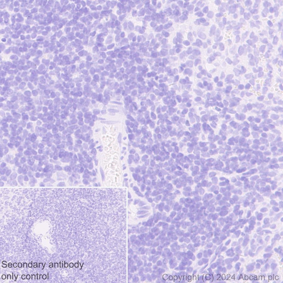 Immunohistochemistry (Formalin/PFA-fixed paraffin-embedded sections) - Anti-Desmoplakin I+II antibody [EPR28426-66] - BSA and Azide free (AB316761), expandable thumbnail
