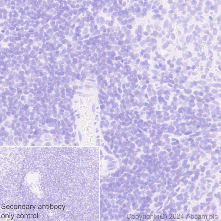 Immunohistochemistry (Formalin/PFA-fixed paraffin-embedded sections) - Anti-Desmoplakin I+II antibody [EPR28426-66] - BSA and Azide free (AB316761)