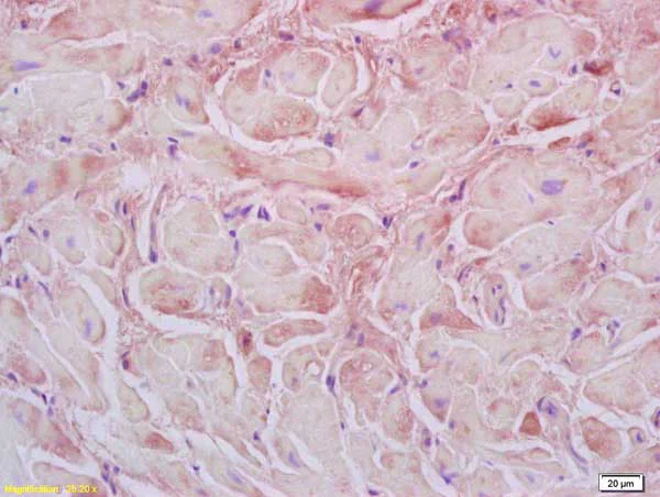 Immunohistochemistry (Formalin/PFA-fixed paraffin-embedded sections) - Anti-Desmuslin/SYN antibody (AB214316)