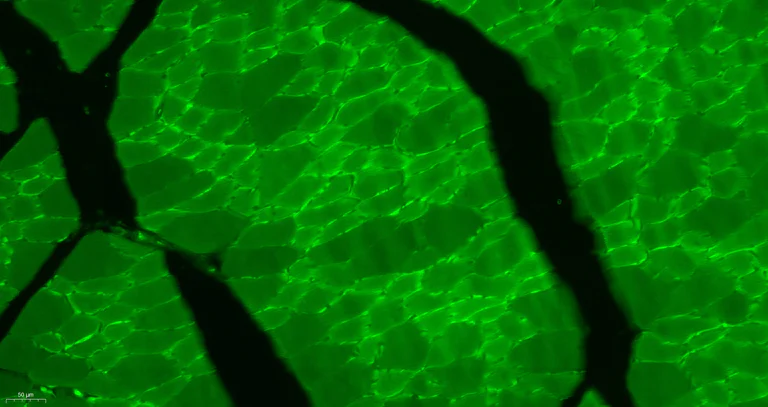 Immunohistochemistry (Formalin/PFA-fixed paraffin-embedded sections) - Anti-Desmuslin/SYN antibody (AB214316)