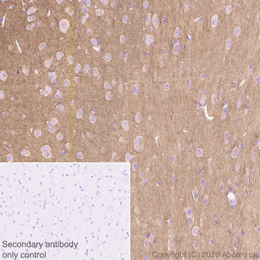 Immunohistochemistry (Formalin/PFA-fixed paraffin-embedded sections) - Anti-Detyrosinated alpha Tubulin antibody [AA12] - Microtubule Marker (ab254154), expandable thumbnail