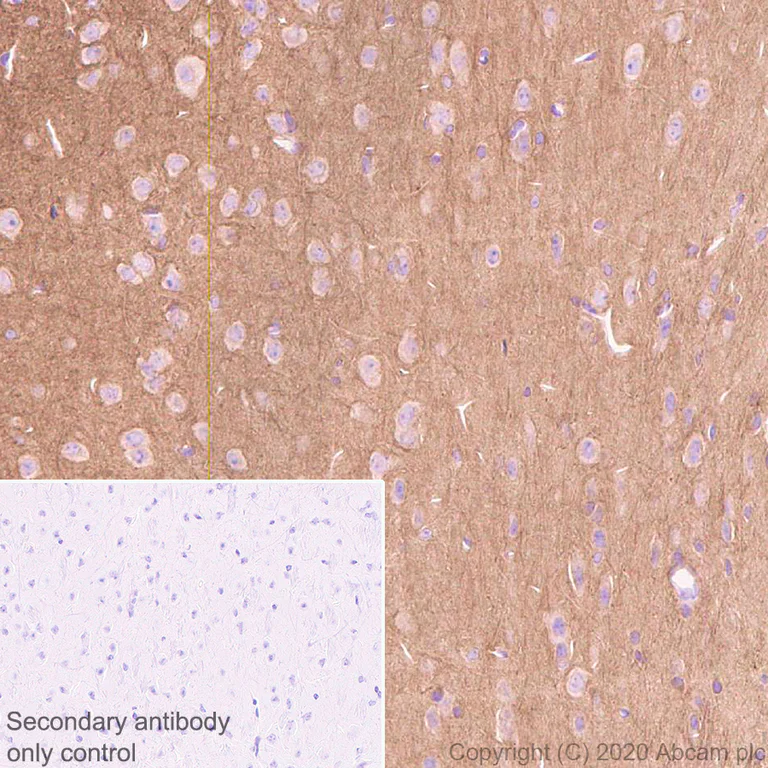 Immunohistochemistry (Formalin/PFA-fixed paraffin-embedded sections) - Anti-Detyrosinated alpha Tubulin antibody [AA12] - Loading Control (AB254154)