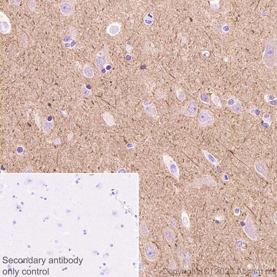 Immunohistochemistry (Formalin/PFA-fixed paraffin-embedded sections) - Anti-Detyrosinated alpha Tubulin antibody [AA12] - Microtubule Marker (ab254154), expandable thumbnail