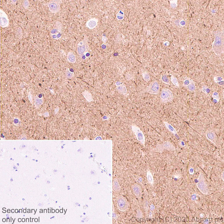 Immunohistochemistry (Formalin/PFA-fixed paraffin-embedded sections) - Anti-Detyrosinated alpha Tubulin antibody [AA12] - Loading Control (AB254154)