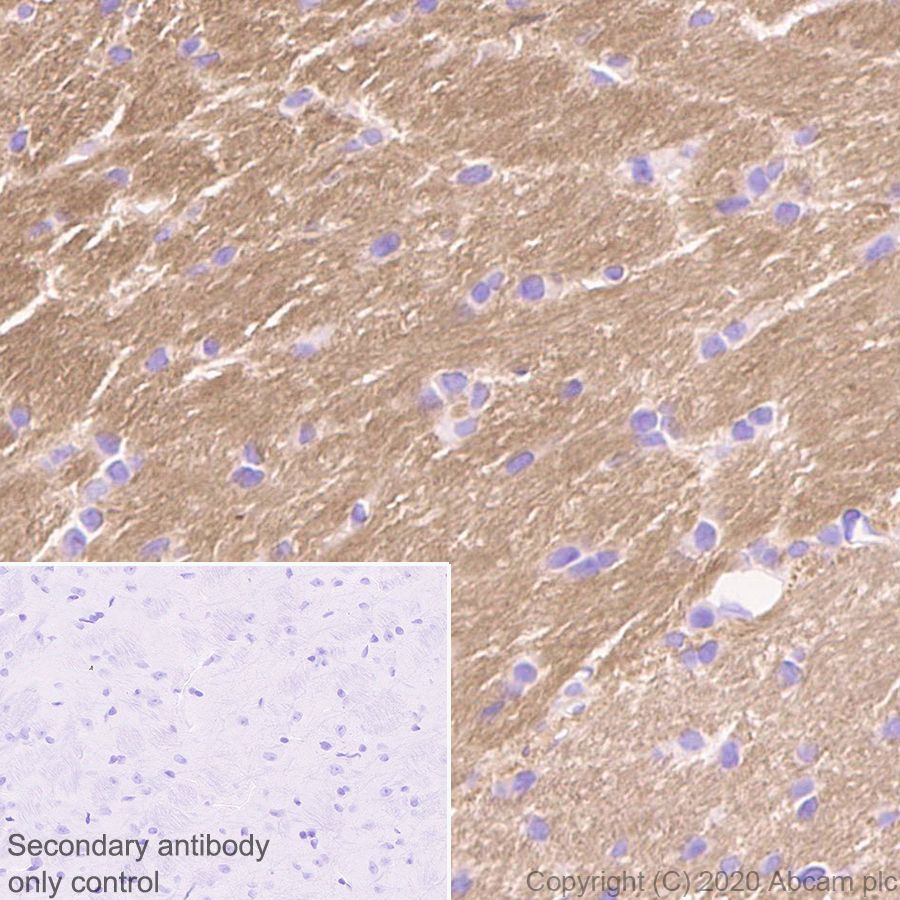 Immunohistochemistry (Formalin/PFA-fixed paraffin-embedded sections) - Anti-Detyrosinated alpha Tubulin antibody [AA12] - Loading Control (ab254154), expandable thumbnail