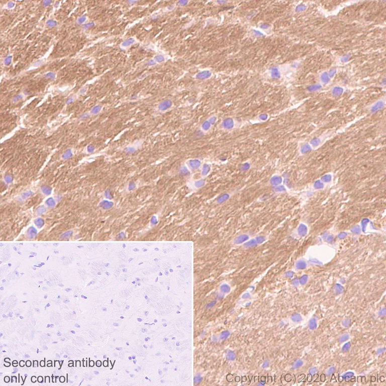 Immunohistochemistry (Formalin/PFA-fixed paraffin-embedded sections) - Anti-Detyrosinated alpha Tubulin antibody [AA12] - Loading Control (AB254154)