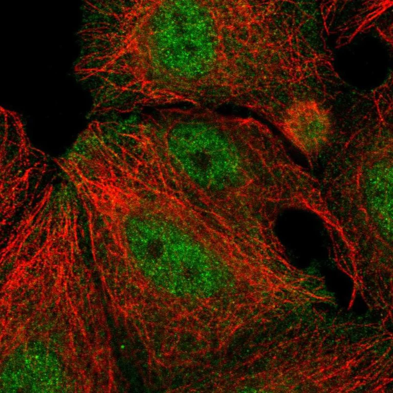 Immunocytochemistry/ Immunofluorescence - Anti-Dexras1 antibody (AB251924)
