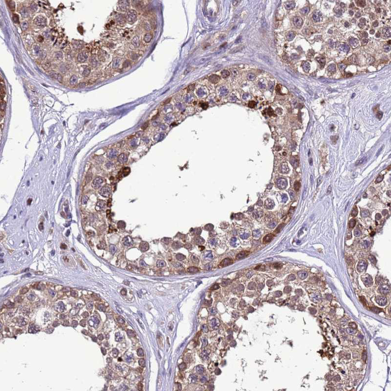 Immunohistochemistry (Formalin/PFA-fixed paraffin-embedded sections) - Anti-Dexras1 antibody (AB251924), expandable thumbnail