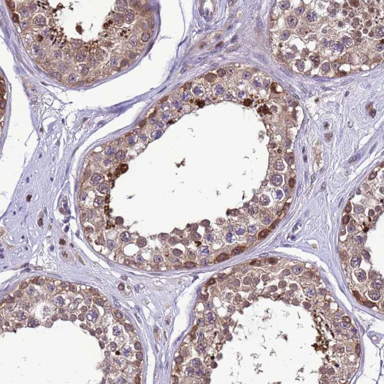 Immunohistochemistry (Formalin/PFA-fixed paraffin-embedded sections) - Anti-Dexras1 antibody (AB251924)