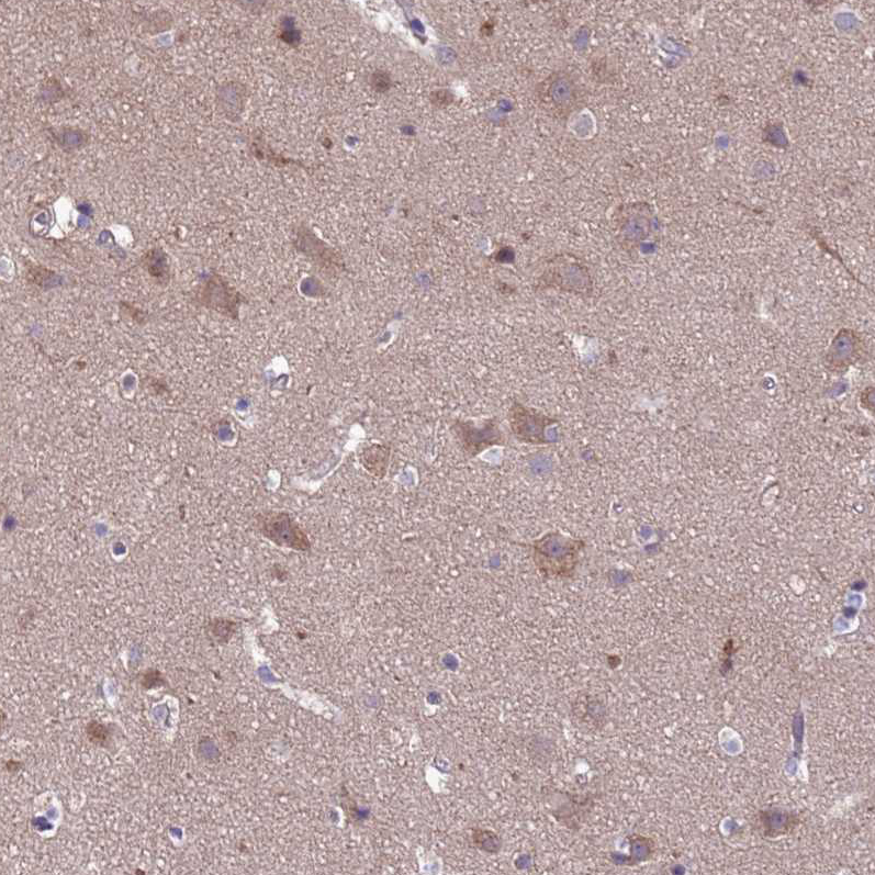 Immunohistochemistry (Formalin/PFA-fixed paraffin-embedded sections) - Anti-Dexras1 antibody (ab251924), expandable thumbnail